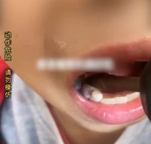 男孩长蛀牙爸爸用电钻钻牙止痛：这种小事自己解决就行！